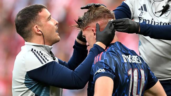 Viktor Gyokeres chảy máu đầu sau pha va chạm với Gabriel